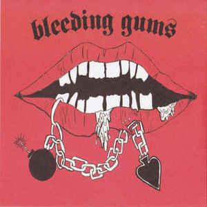 Bleeding Gums - II